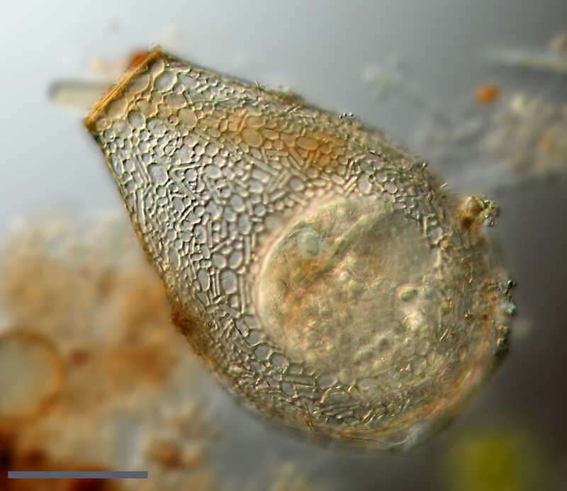 Image of Nebela collaris