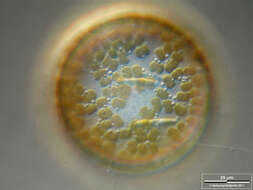 Image of Diatom