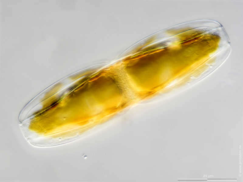 Image of <i>Plagiotropis gibberula</i> Grunow 1880