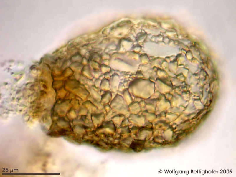 Image of Difflugia serrata