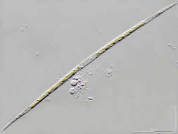 Слика од <i>Closterium acutum</i> var. <i>linea</i>