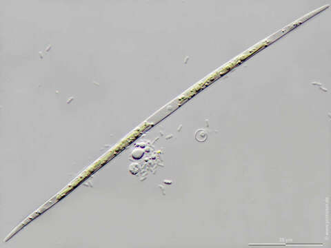 Image of <i>Closterium acutum</i> var. <i>linea</i>
