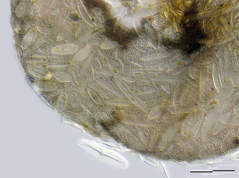 Image of Centropyxis lapponica