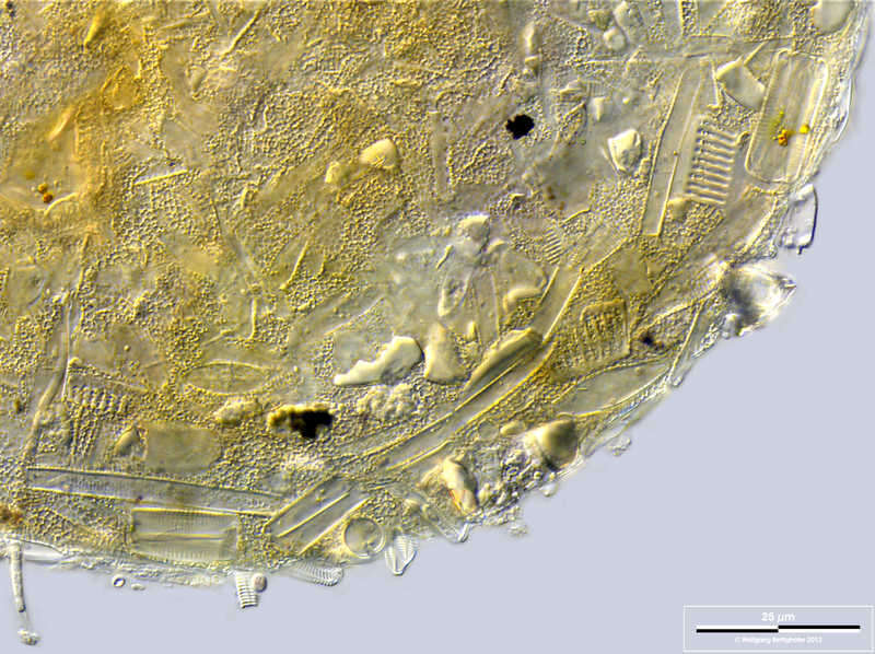 Image of Centropyxis lapponica