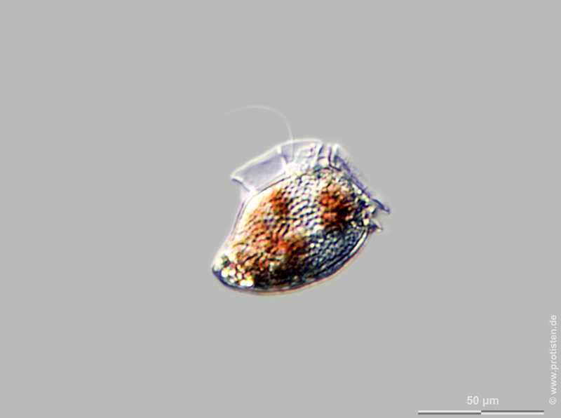 Слика од Dinophysis acuta