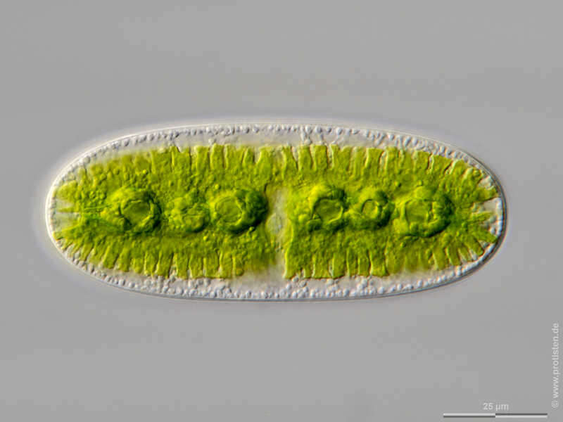 Image of Netrium oblongum