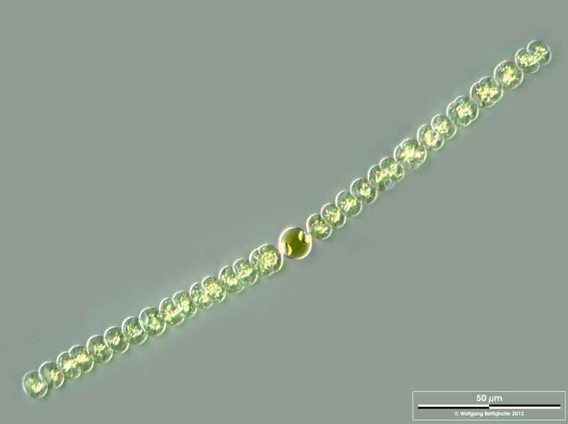Image of Dolichospermum sigmoideum