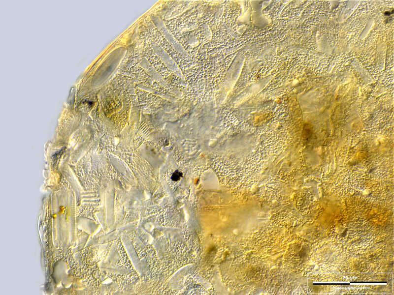 Image of Centropyxis lapponica