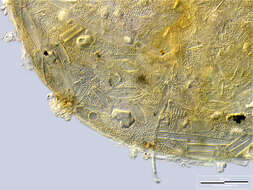Image of Centropyxis lapponica