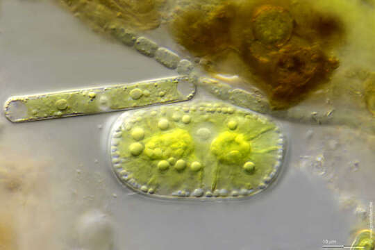 صورة Cylindrocystis crassa