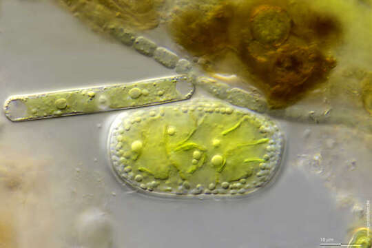 صورة Cylindrocystis crassa