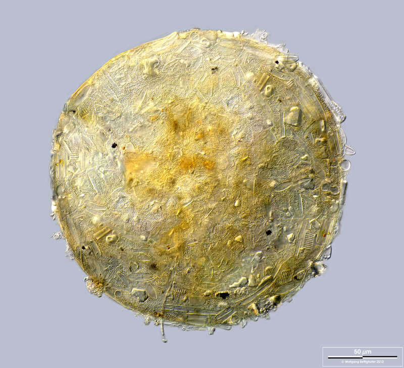 Image of Centropyxis lapponica