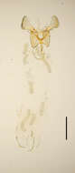 Image of Parornix atripalpella Wahlström 1979