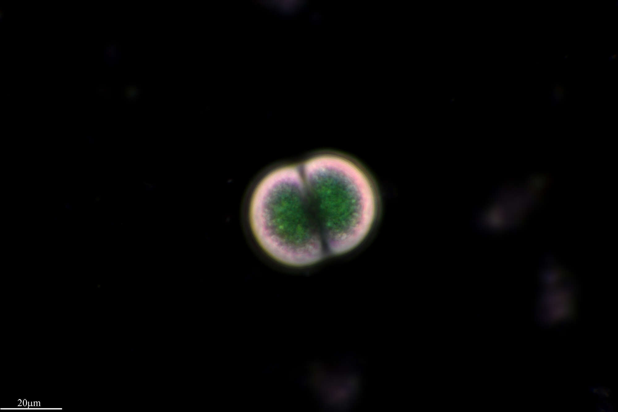 Chroococcus turgidus resmi