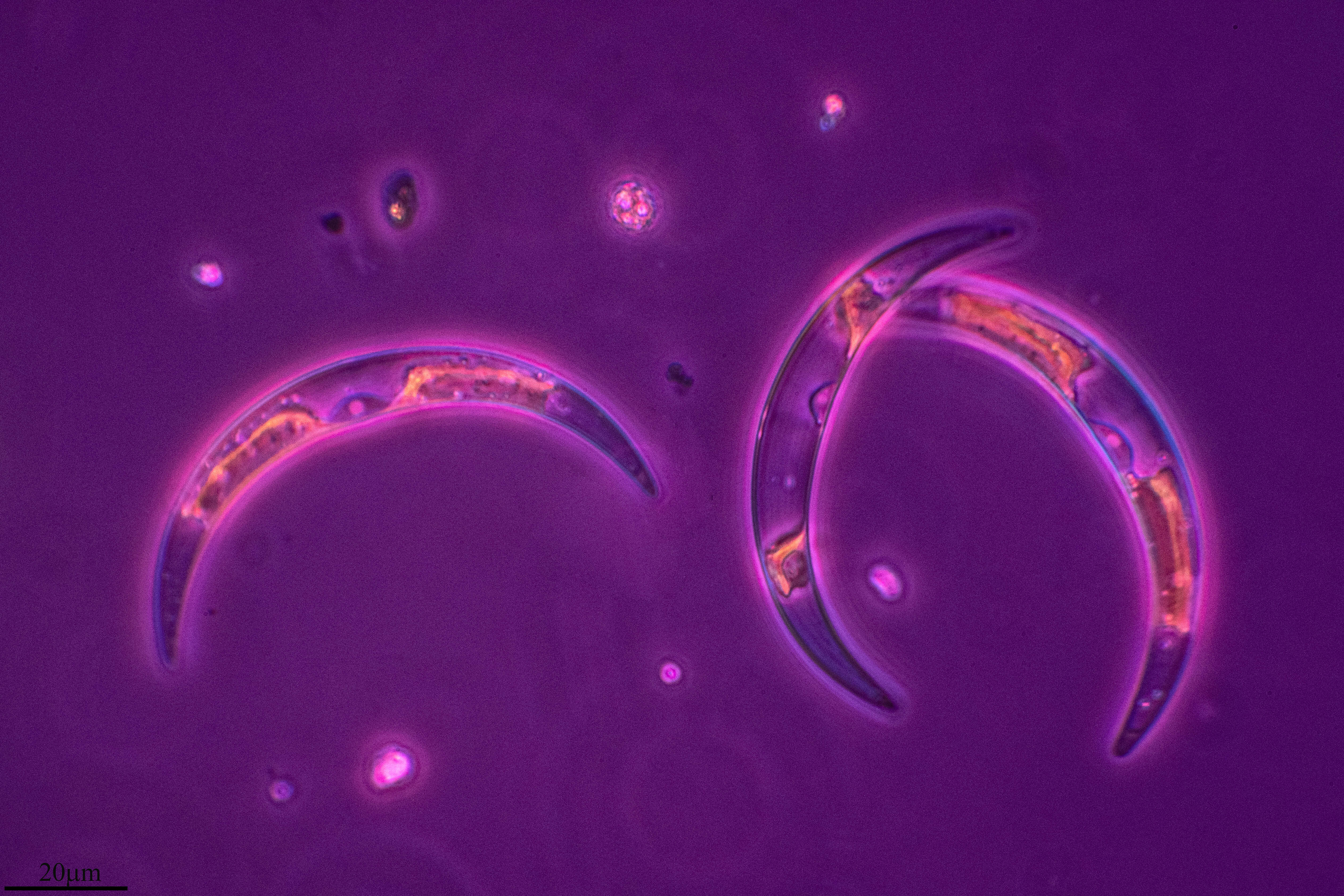 Closterium dianae Ehrenberg ex Ralfs 1848 resmi