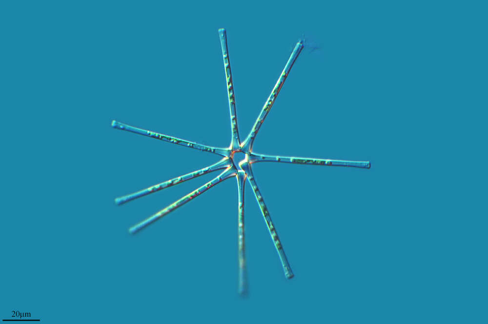 Image of Asterionella formosa