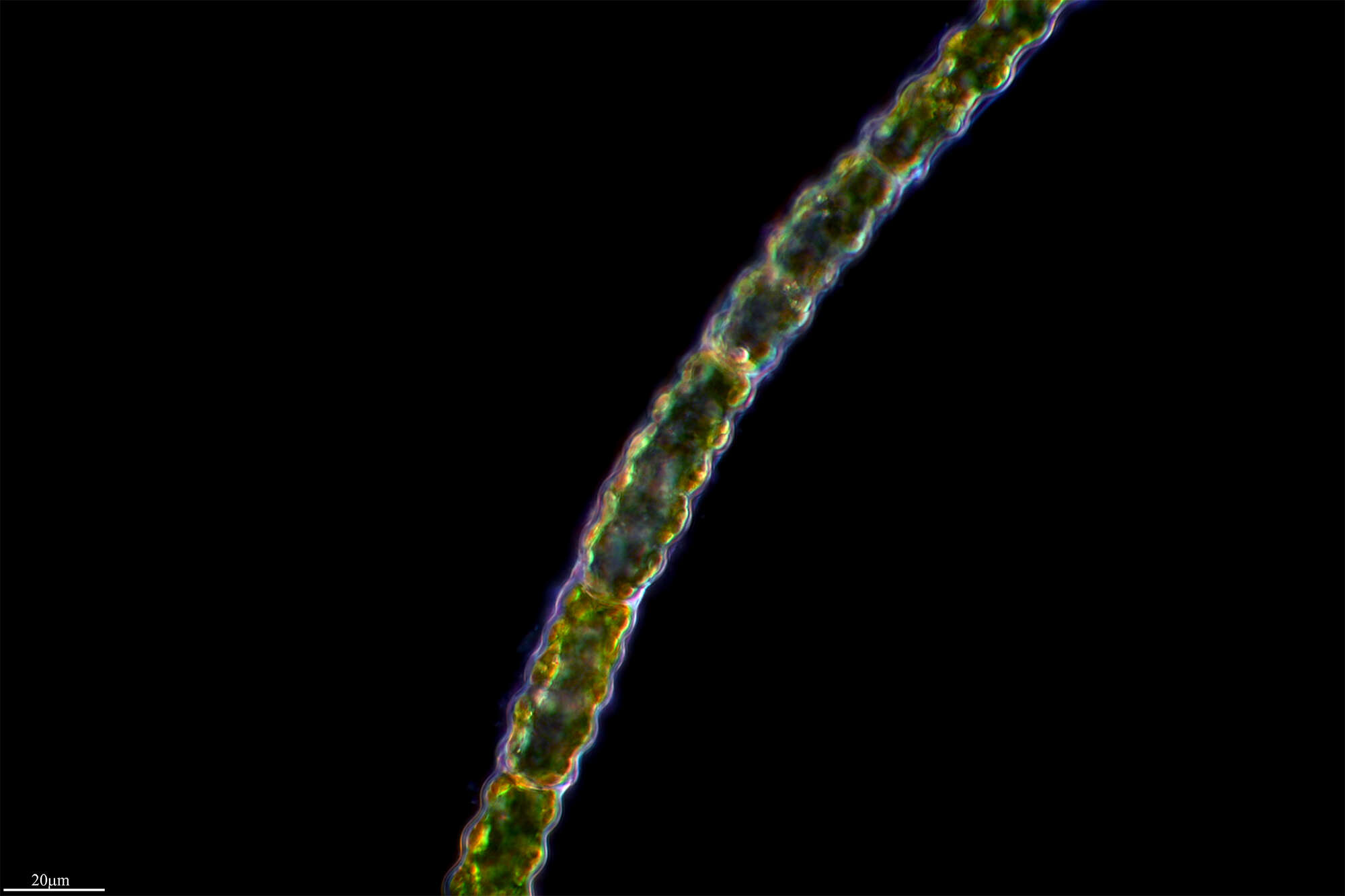 Слика од Oedogonium undulatum