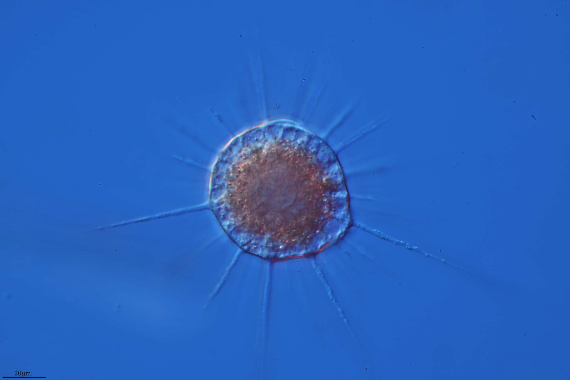 Image of Actinophrys sol