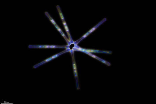 Image of Asterionella formosa