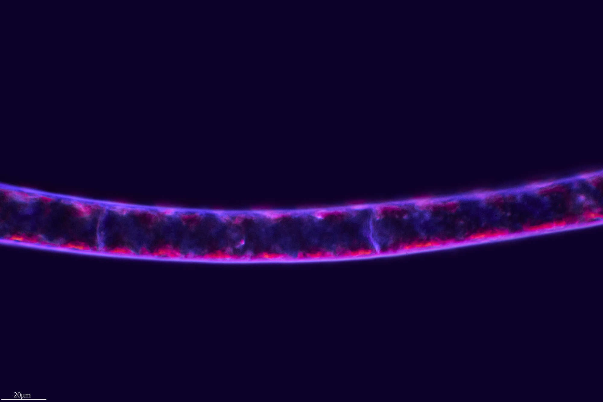 Spirogyra XX resmi