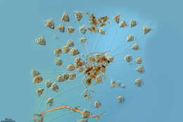 Image de Vorticella convallaria