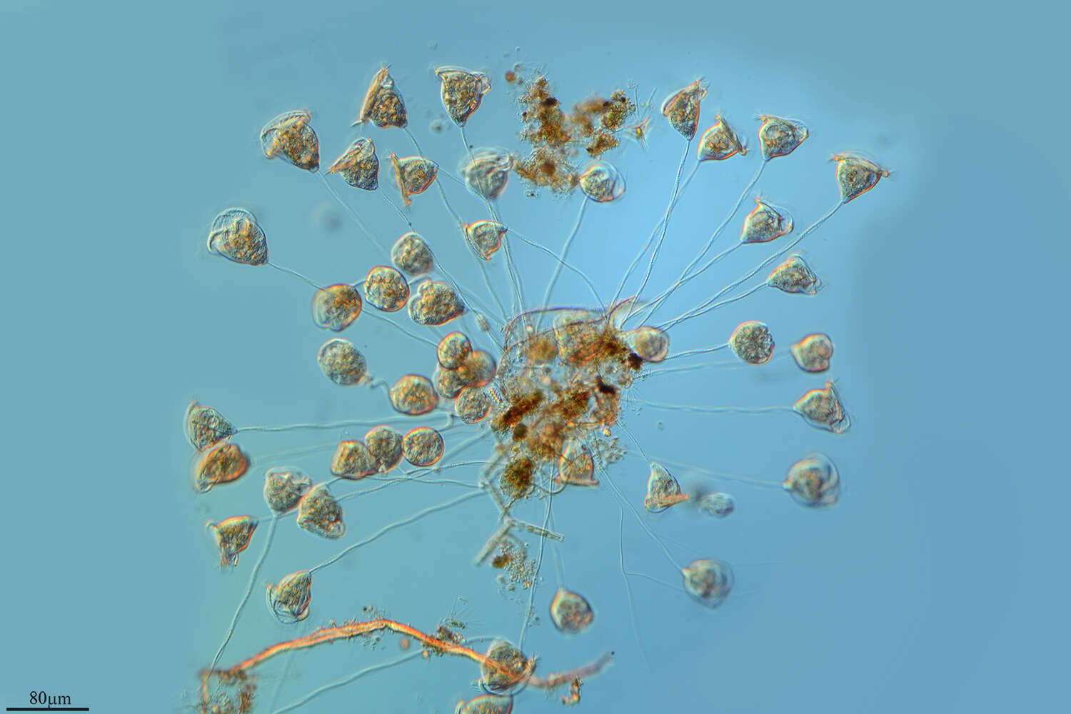 Image de Vorticella convallaria