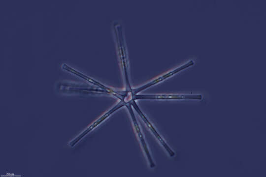 Image of Asterionella formosa