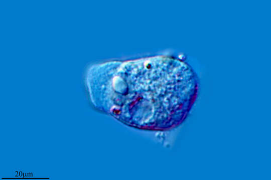 Image of Dermamoeba algensis