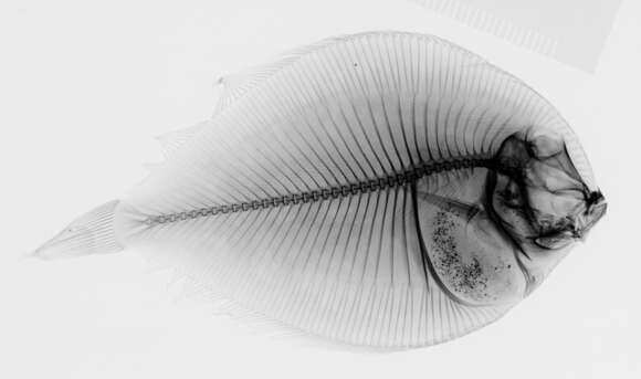 Image of Pacific eyed flounder