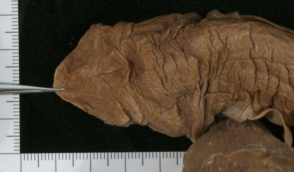 Image of Echinorhinus