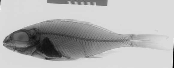 Image de Cardiopharynx