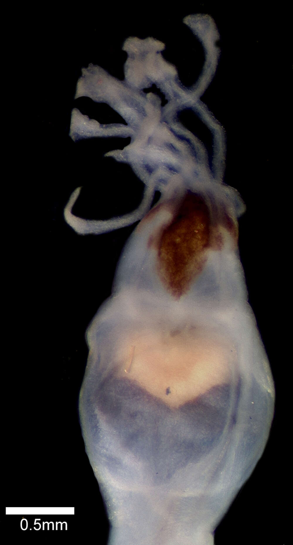 Image of Gigantactis microdontis Bertelsen, Pietsch & Lavenberg 1981