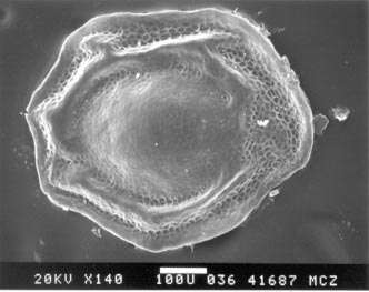 صورة Phrynocephalus interscapularis Lichtenstein 1856