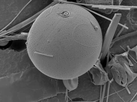 Image of SAR (Stramenopiles, Alveolates, Rhizaria)
