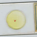 Image of Lepocreadium areolatum (Linton 1900) Stunkard 1969