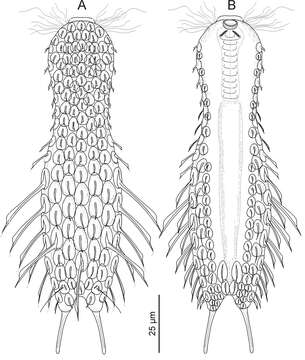 Image of gastrotrichs