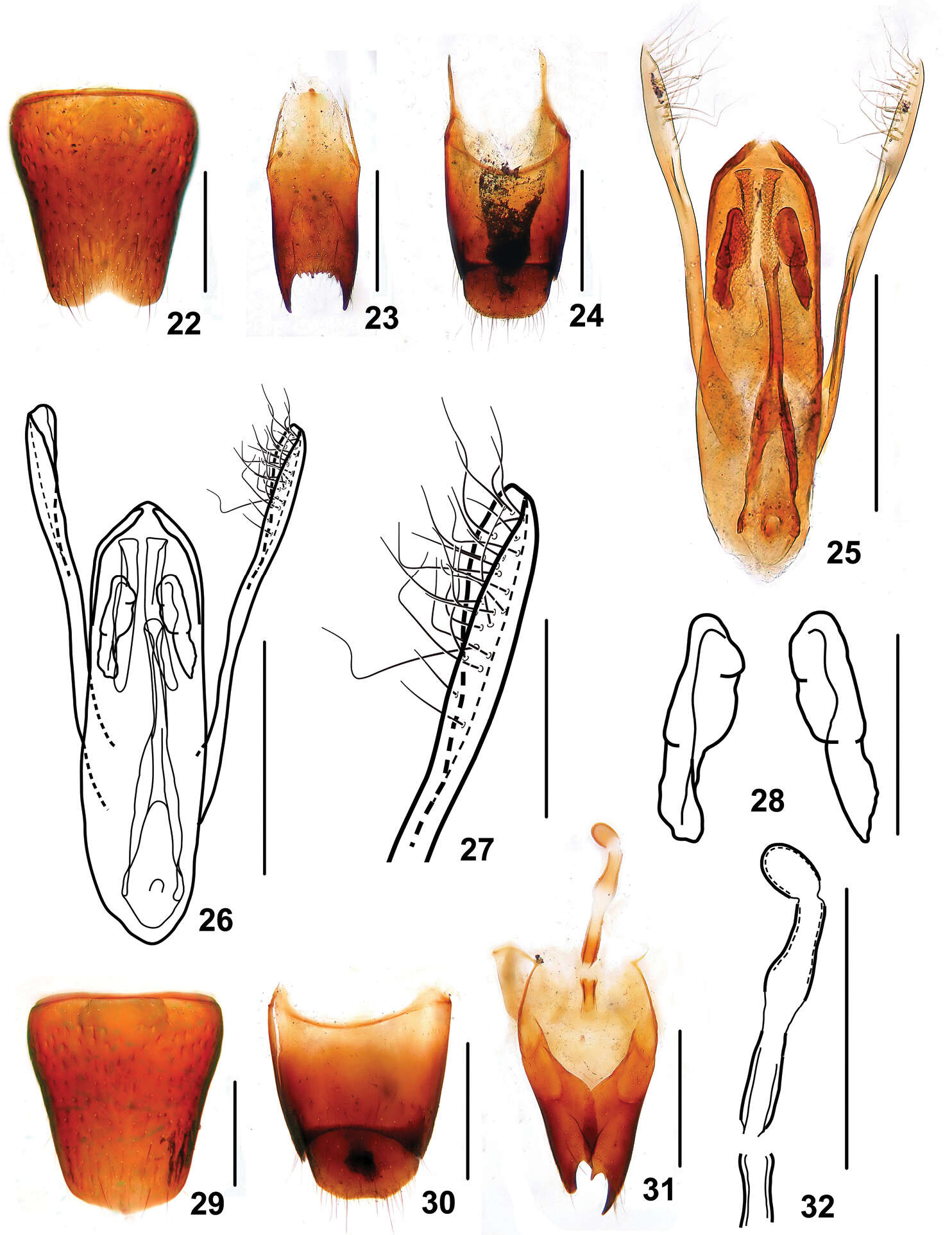 Image of Stenus hewenjiae Tang, Liang & Li-Zhen Li 2012