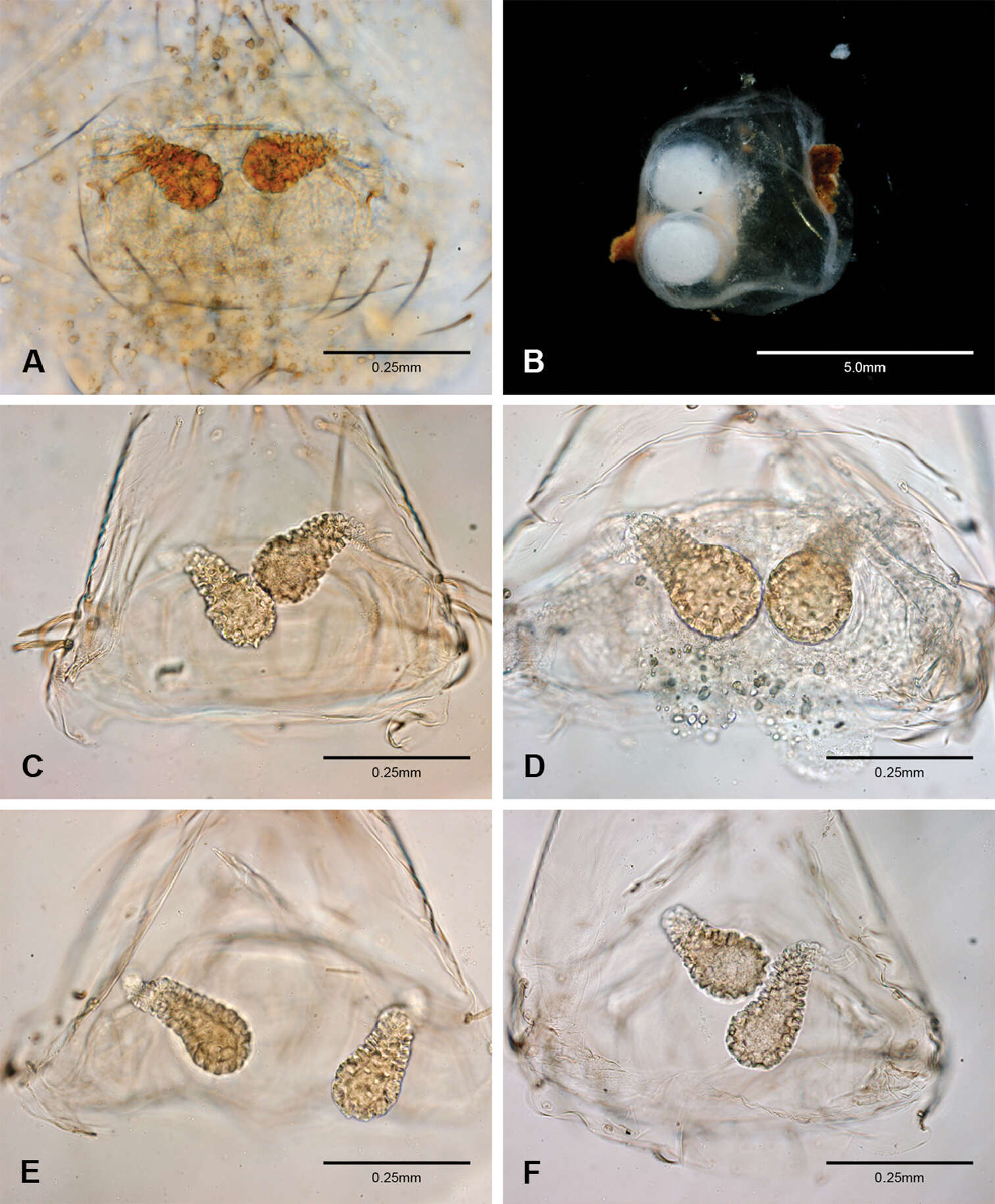 Image of leptonetid spiders