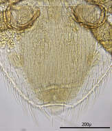 Image of mesostigmatan mites