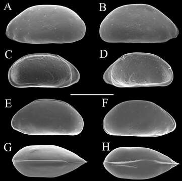 Image of Parvocythere Hartmann 1959