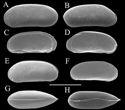 Image de Parvocythere gracilis Higashi & Tsukagoshi 2012