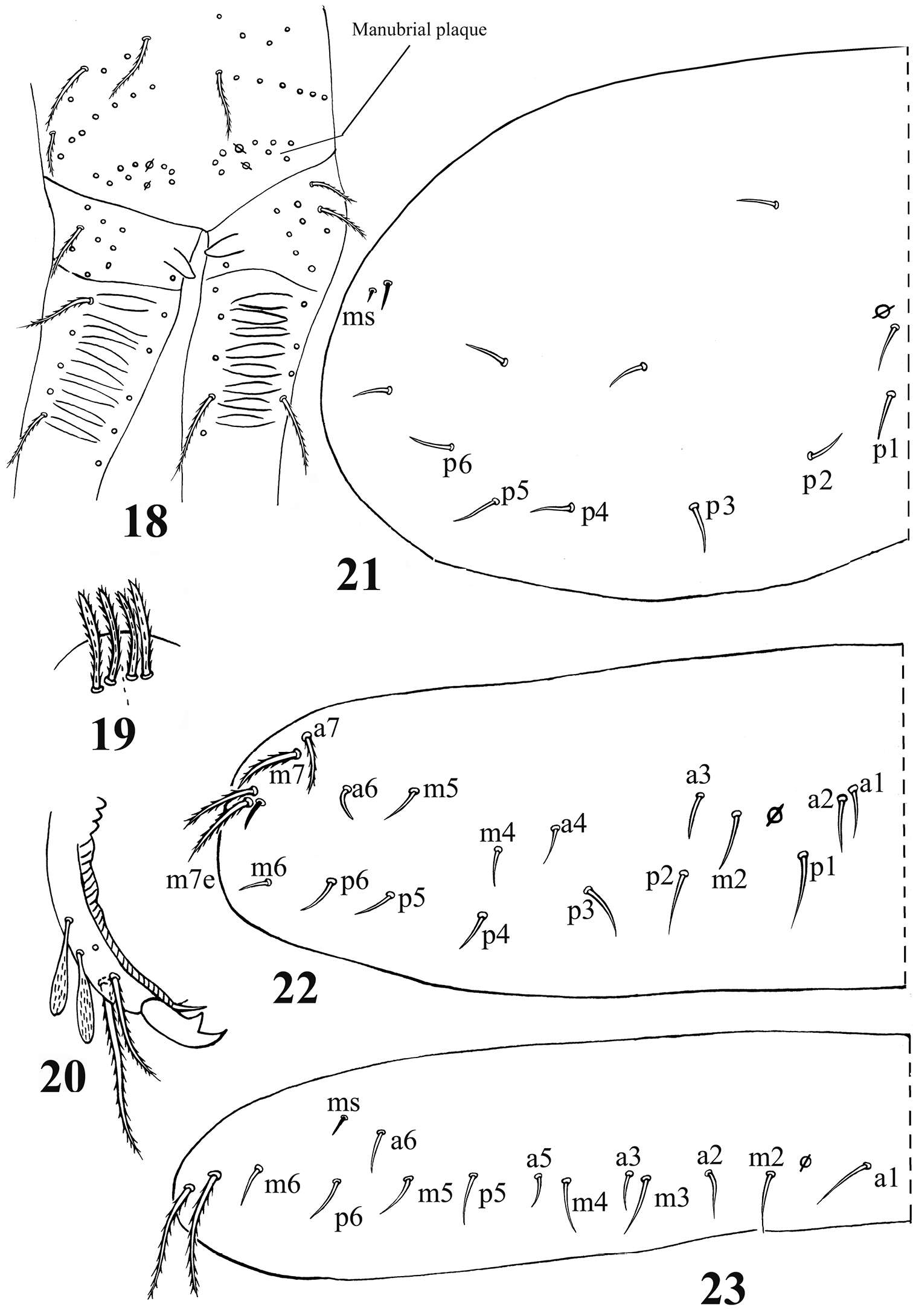 Image of Acrocyrtus zhujiensis Xu, Pan & Zhang 2013