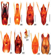 Image of Stenus (Stenus) secretus Bernhauer 1915