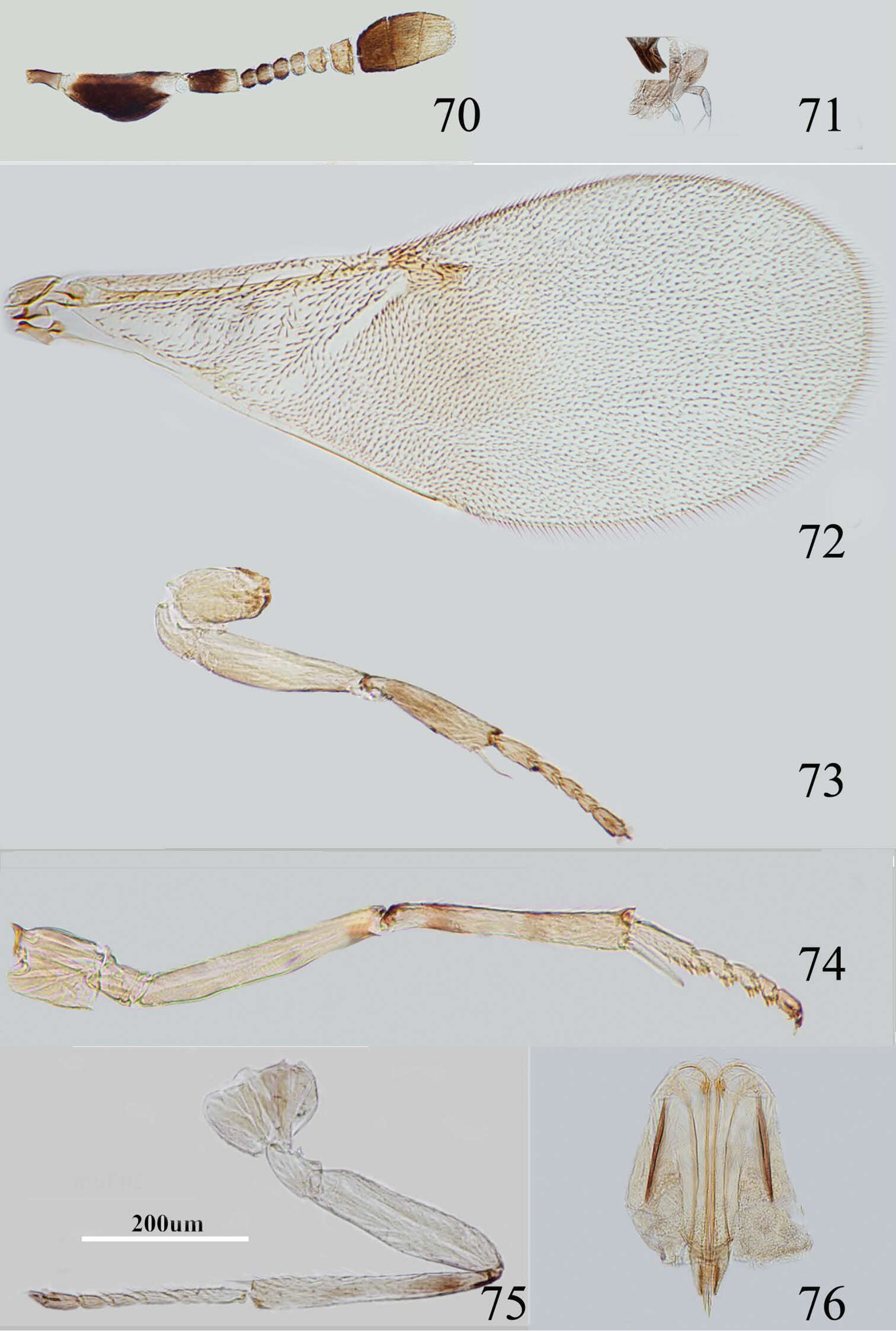 Image de Metaphycus fusiformis Wang, Li & Zhang 2013