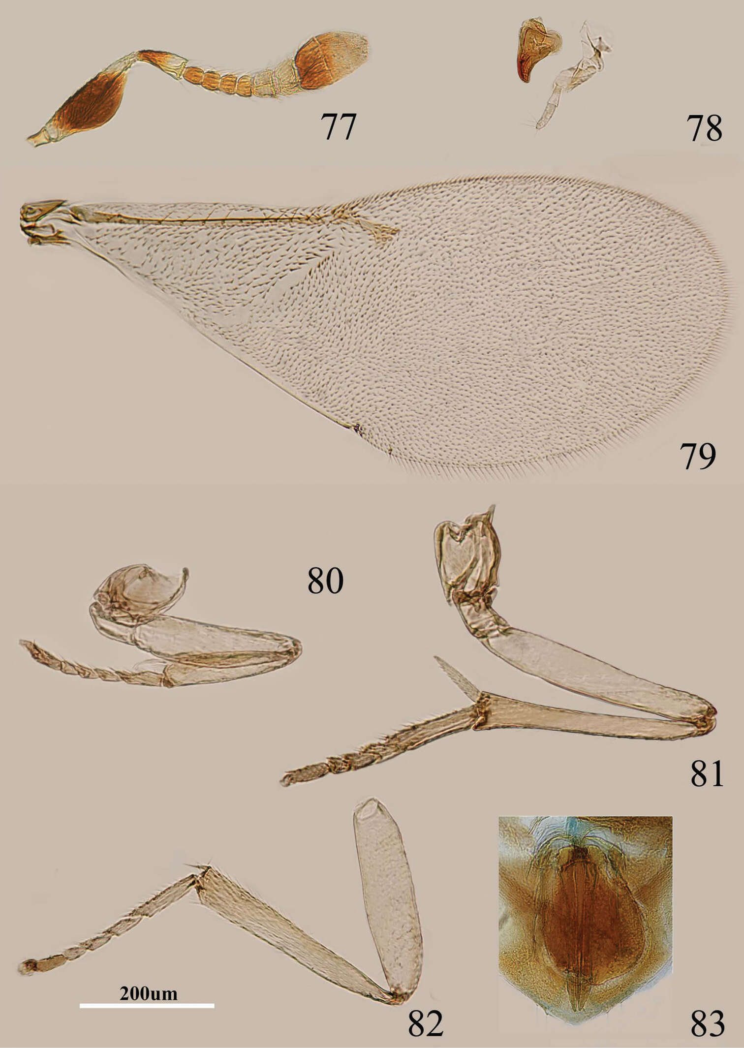 Image de <i>Metaphycus xujiangi</i> Oezdikmen 2011