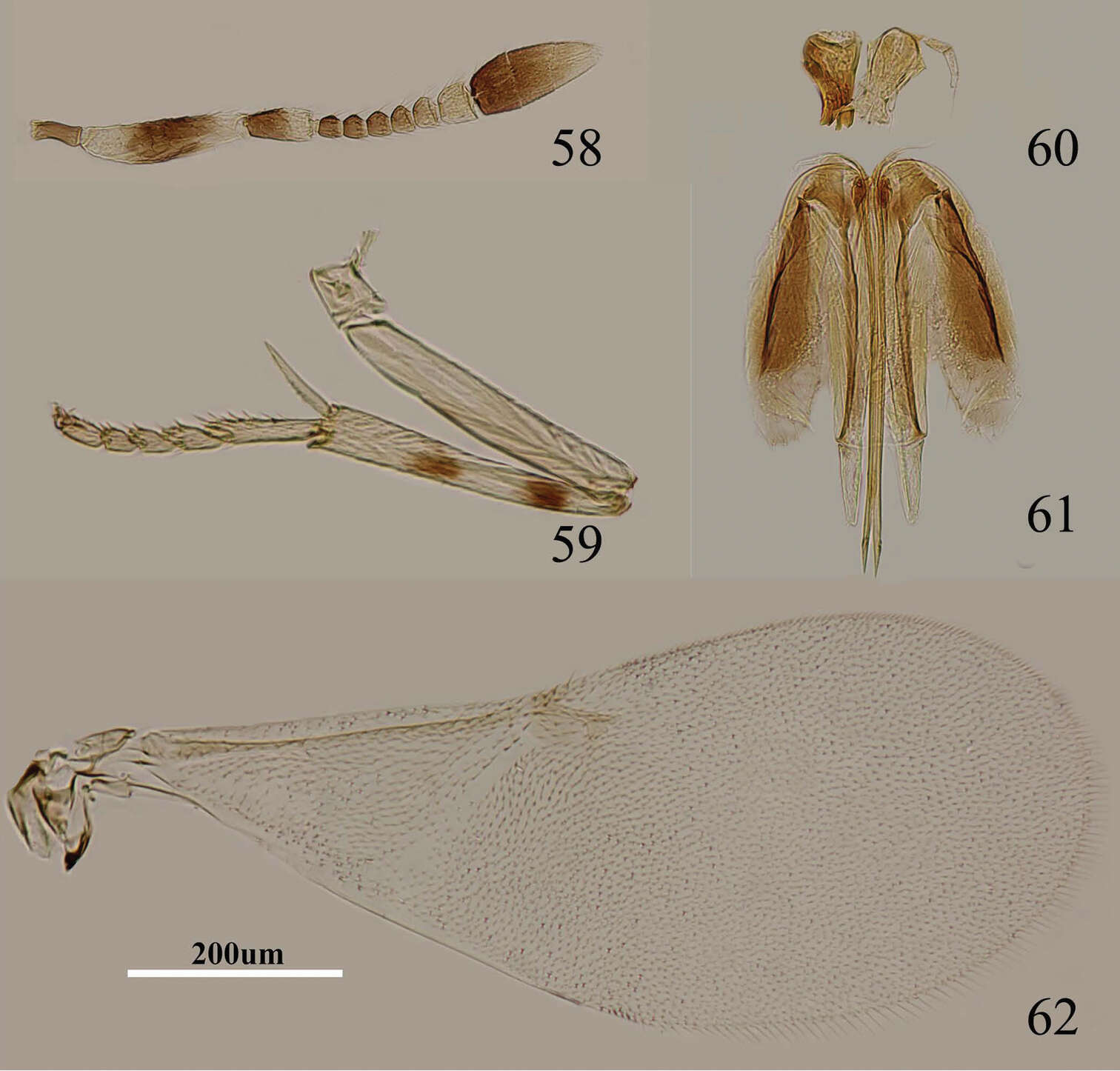 Imagem de Metaphycus nadius (Walker 1838)