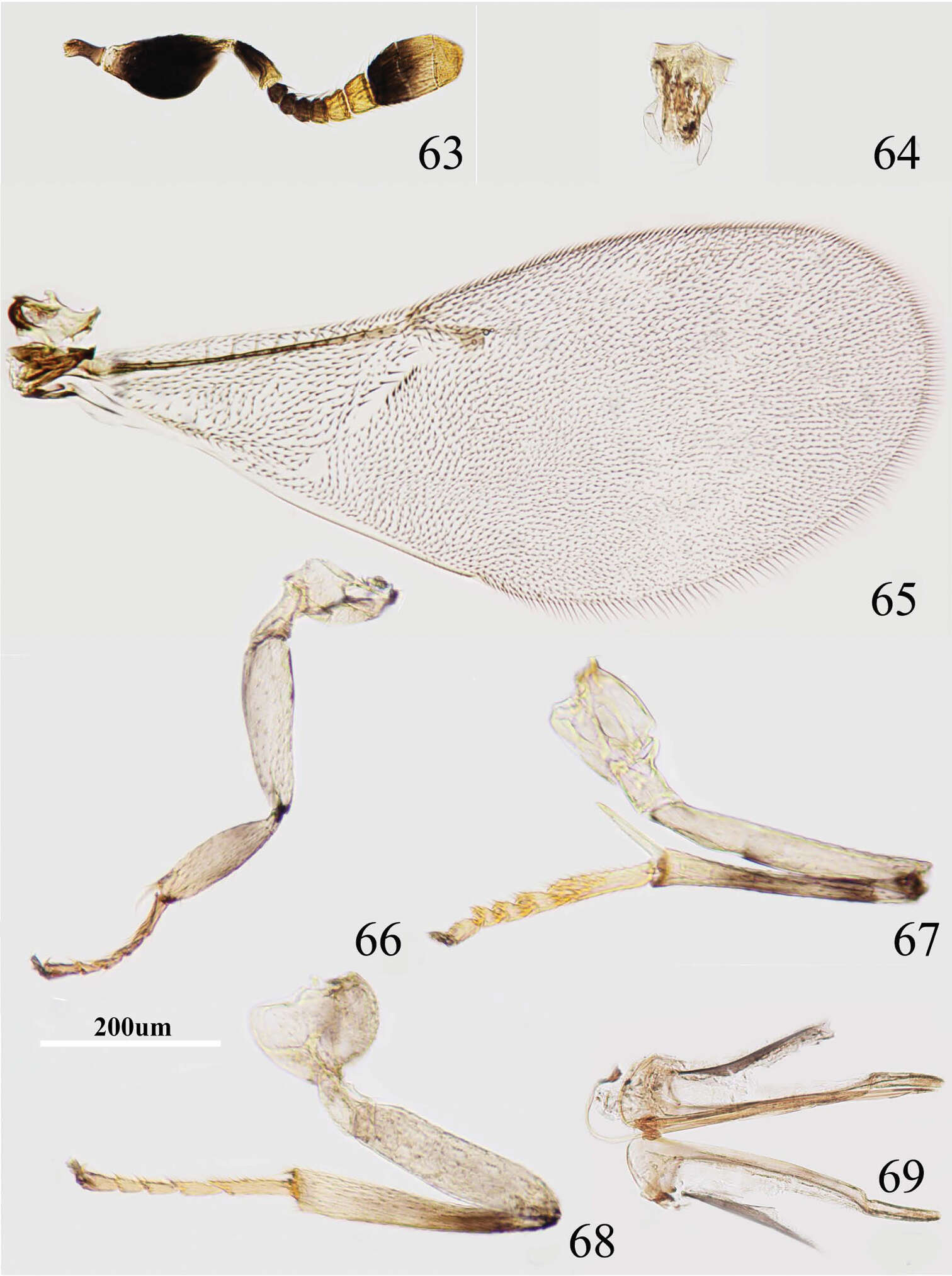 Image de Metaphycus fusiscapus Wang, Li & Zhang 2013