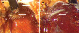 Image of Cymatodera rubida Burke