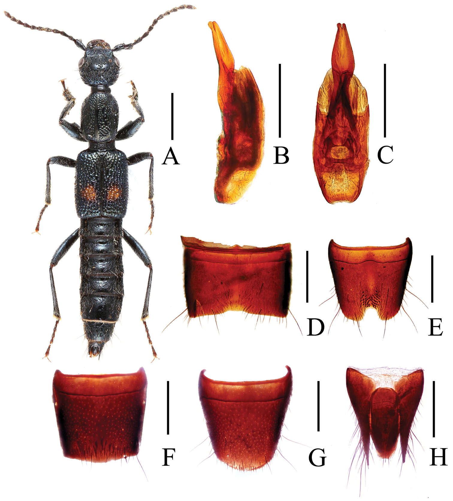 Image of Lobrathium ablectum Assing 2012