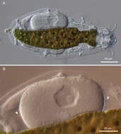 Image of gastrotrichs